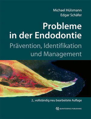 Buchcover Probleme in der Endodontie | Michael Hülsmann | EAN 9783868673661 | ISBN 3-86867-366-0 | ISBN 978-3-86867-366-1