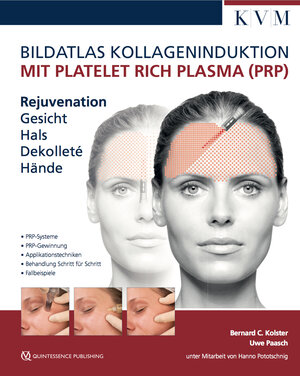 Buchcover Bildatlas Kollageninduktion mit Platelet Rich Plasma (PRP) | Uwe Paasch | EAN 9783868673760 | ISBN 3-86867-376-8 | ISBN 978-3-86867-376-0