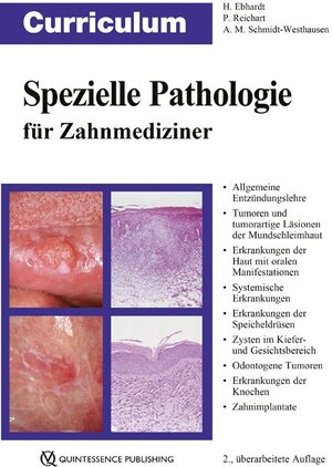 Buchcover Curriculum Spezielle Pathologie für Zahnmediziner | Harald Ebhardt | EAN 9783868673876 | ISBN 3-86867-387-3 | ISBN 978-3-86867-387-6