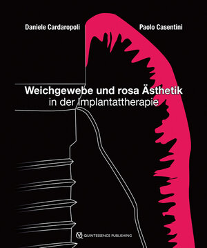 Buchcover Weichgewebe und rosa Ästhetik in der Implantattherapie | Daniele Cardaropoli | EAN 9783868674804 | ISBN 3-86867-480-2 | ISBN 978-3-86867-480-4