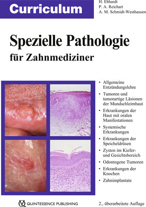 Buchcover Curriculum Spezielle Pathologie für Zahnmediziner | Harald Ebhardt | EAN 9783868674811 | ISBN 3-86867-481-0 | ISBN 978-3-86867-481-1