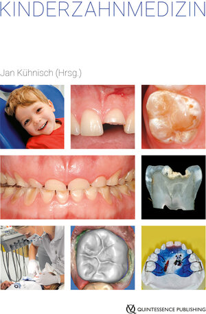 Buchcover Kinderzahnmedizin  | EAN 9783868675023 | ISBN 3-86867-502-7 | ISBN 978-3-86867-502-3