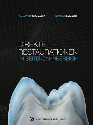 Buchcover Direkte Restaurationen im Seitenzahnbereich | Salvatore Scolavino | EAN 9783868675146 | ISBN 3-86867-514-0 | ISBN 978-3-86867-514-6