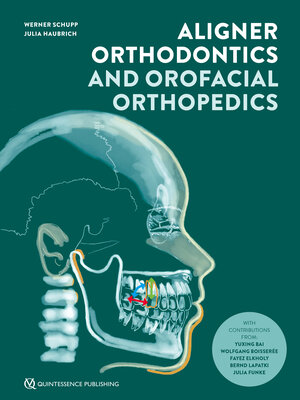 Buchcover Aligner Orthodontics and Orofacial Orthopedics | Werner Schupp | EAN 9783868676556 | ISBN 3-86867-655-4 | ISBN 978-3-86867-655-6