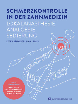 Buchcover Schmerzkontrolle in der Zahnmedizin | Peer W. Kämmerer | EAN 9783868676914 | ISBN 3-86867-691-0 | ISBN 978-3-86867-691-4