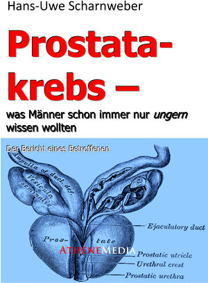 Buchcover Prostatakrebs | Hans-Uwe Scharnweber | EAN 9783869921136 | ISBN 3-86992-113-7 | ISBN 978-3-86992-113-6
