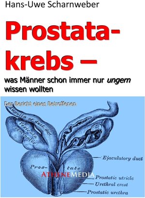 Buchcover Prostatakrebs | Hans-Uwe Scharnweber | EAN 9783869922508 | ISBN 3-86992-250-8 | ISBN 978-3-86992-250-8