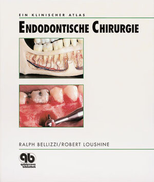 Endodontische Chirurgie: Ein klinischer Atlas