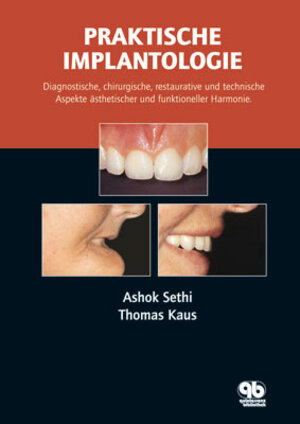 Buchcover Praktische Implantologie | Ashok Sethi | EAN 9783876526829 | ISBN 3-87652-682-5 | ISBN 978-3-87652-682-9