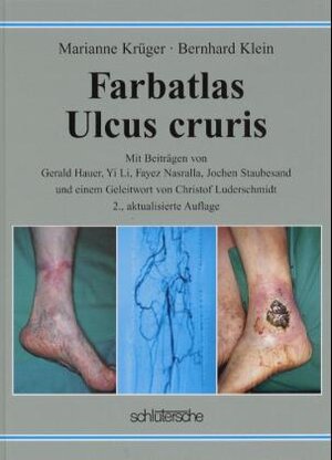 Farbatlas Ulcus Cruris