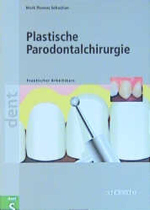 Plastische Parodontalchirurgie: Praktischer Arbeitskurs. Informationen über Mikrobiologie, Nahttechniken, Ursachen und Indikationen verschiedener ... ... Kronenverlängerung, Rezessionsdeckung uvm