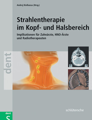 Buchcover Strahlentherapie im Kopf- und Halsbereich  | EAN 9783877068700 | ISBN 3-87706-870-7 | ISBN 978-3-87706-870-0