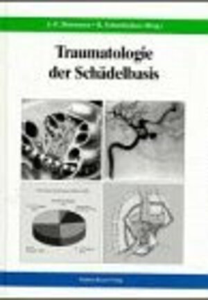 Buchcover Traumatologie der Schädelbasis | Jarg-Erich Hausamen | EAN 9783887564858 | ISBN 3-88756-485-5 | ISBN 978-3-88756-485-8