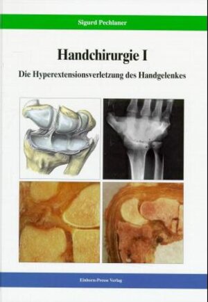 Handchirurgie