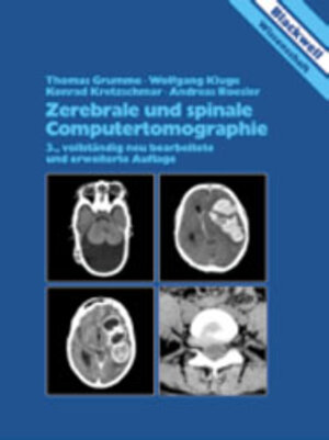 Buchcover Zerebrale und spinale Computertomographie | Thomas Grumme | EAN 9783894122881 | ISBN 3-89412-288-9 | ISBN 978-3-89412-288-1