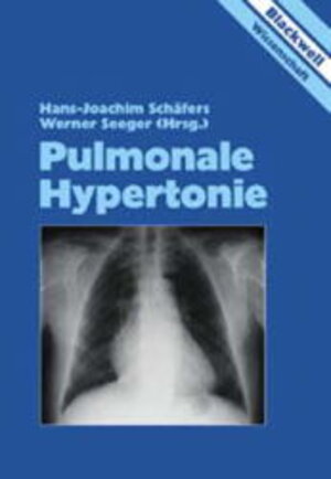 Buchcover Pulmonale Hypertonie  | EAN 9783894124830 | ISBN 3-89412-483-0 | ISBN 978-3-89412-483-0