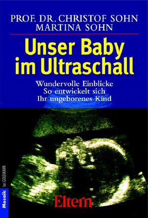 Buchcover Unser Baby im Ultraschall | Christof Sohn | EAN 9783894807580 | ISBN 3-89480-758-X | ISBN 978-3-89480-758-0