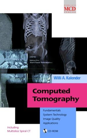 Buchcover Computed Tomography | Willi Kalender | EAN 9783895780813 | ISBN 3-89578-081-2 | ISBN 978-3-89578-081-3