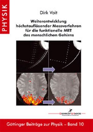 Buchcover Weiterentwicklung höchstauflösender Messverfahren für die funktionelle MRT des menschlichen Gehirns | Dirk Voit | EAN 9783897442498 | ISBN 3-89744-249-3 | ISBN 978-3-89744-249-8