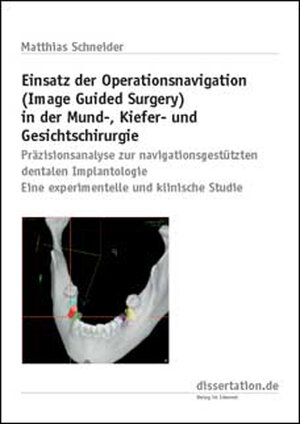 Buchcover Einsatz der Operationsnavigation (Image Guided Surgery) in der Mund-, Kiefer- und Gesichtschirurgie | Matthias Schneider | EAN 9783898253567 | ISBN 3-89825-356-2 | ISBN 978-3-89825-356-7