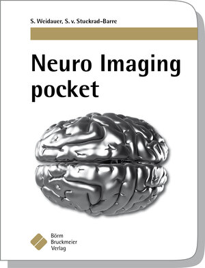 Buchcover Neuro Imaging pocket | Stefan Weidauer | EAN 9783898627498 | ISBN 3-89862-749-7 | ISBN 978-3-89862-749-8