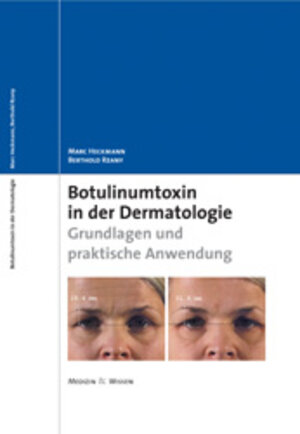 Buchcover Botulinumtoxin in der Dermatologie | Marc Heckmann | EAN 9783899351774 | ISBN 3-89935-177-0 | ISBN 978-3-89935-177-4