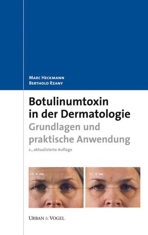 Buchcover Botulinumtoxin in der Dermatologie | Marc Heckmann | EAN 9783899352115 | ISBN 3-89935-211-4 | ISBN 978-3-89935-211-5
