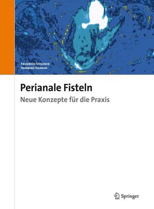 Buchcover Perianale Fisteln | Friedrich Stelzner | EAN 9783899352665 | ISBN 3-89935-266-1 | ISBN 978-3-89935-266-5