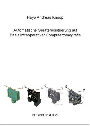 Buchcover Automatische Geräteregistrierung auf Basis intraoperativer Computertomografie | Hayo A Knoop | EAN 9783899593600 | ISBN 3-89959-360-X | ISBN 978-3-89959-360-0