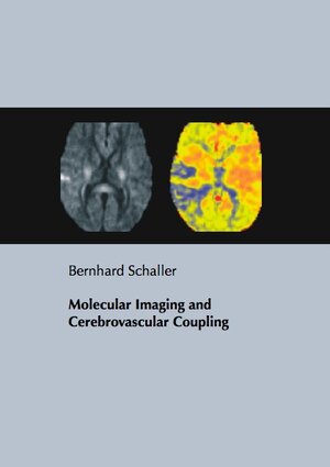 Buchcover Molecular Imaging and Cerebrovascular Coupling | Bernhard Schaller | EAN 9783899634686 | ISBN 3-89963-468-3 | ISBN 978-3-89963-468-6
