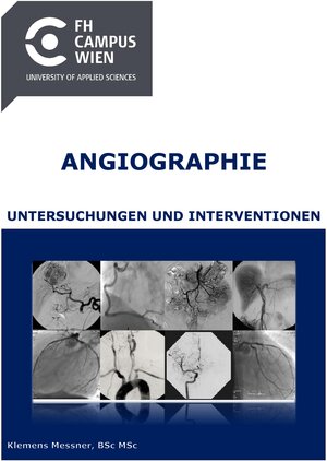 Buchcover Angiographie - Untersuchungen und Interventionen | Klemens Messner | EAN 9783902614476 | ISBN 3-902614-47-1 | ISBN 978-3-902614-47-6