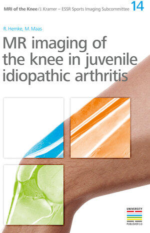 Buchcover 14. MR imaging of the knee in juvenile idiopathic arthritis | M. Maas | EAN 9783902933195 | ISBN 3-902933-19-4 | ISBN 978-3-902933-19-5