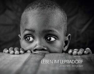 Buchcover Leben im Lepradorf | Joachim Bergauer | EAN 9783903078178 | ISBN 3-903078-17-4 | ISBN 978-3-903078-17-8