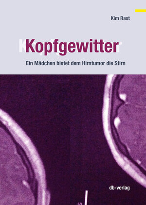 Buchcover Kopfgewitter | Kim Rast | EAN 9783905388534 | ISBN 3-905388-53-7 | ISBN 978-3-905388-53-4