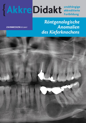 Buchcover Röntgenologische Anomalien des Kieferknochens | Isaac van der Waal | EAN 9783910487017 | ISBN 3-910487-01-7 | ISBN 978-3-910487-01-7