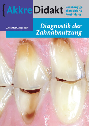 Buchcover Diagnostik der Zahnabnutzung | Peter Wetselaar | EAN 9783910487031 | ISBN 3-910487-03-3 | ISBN 978-3-910487-03-1