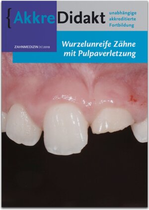Buchcover Wurzelunreife Zähne mit Pulpaverletzung | Marga Ree | EAN 9783910487055 | ISBN 3-910487-05-X | ISBN 978-3-910487-05-5