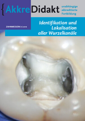 Buchcover Identifikation und Lokalisation aller Wurzelkanäle | Michael Drefs | EAN 9783910487093 | ISBN 3-910487-09-2 | ISBN 978-3-910487-09-3