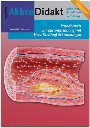 Buchcover Parodontitis im Zusammenhang mit Herz-Kreislauf-Erkrankungen | Bruno Loos | EAN 9783910487109 | ISBN 3-910487-10-6 | ISBN 978-3-910487-10-9