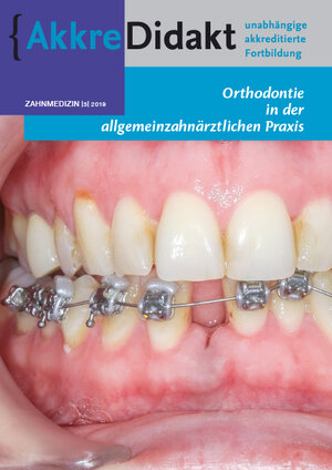 Buchcover Orthodontie in der allgemeinzahnärztlichen Praxis | Nicoline van der Kaaij | EAN 9783910487116 | ISBN 3-910487-11-4 | ISBN 978-3-910487-11-6