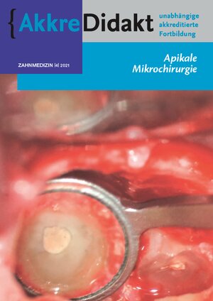 Buchcover Apikale Mikrochirurgie | Fenneke Dommering | EAN 9783910487208 | ISBN 3-910487-20-3 | ISBN 978-3-910487-20-8