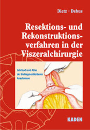 Buchcover Resektions- und Rekonstruktionsverfahren in der Viszeralchirurgie | Ulrich A Dietz | EAN 9783922777441 | ISBN 3-922777-44-9 | ISBN 978-3-922777-44-1