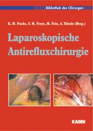 Buchcover Laparoskopische Antirefluxchirurgie  | EAN 9783922777465 | ISBN 3-922777-46-5 | ISBN 978-3-922777-46-5