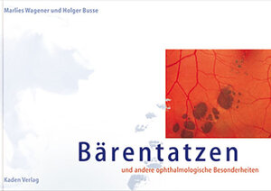 Bärentatzen und andere ophthalmologische Besonderheiten