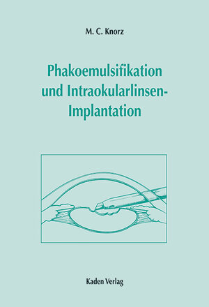 Buchcover Phakoemulsifikation und Intraokularlinsen-Implantation | M C Knorz | EAN 9783922777670 | ISBN 3-922777-67-8 | ISBN 978-3-922777-67-0