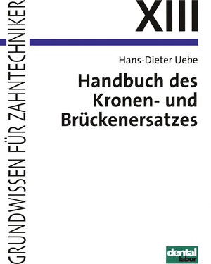 Buchcover Handbuch des Kronen- und Brückenersatzes | Hans D Uebe | EAN 9783929360097 | ISBN 3-929360-09-8 | ISBN 978-3-929360-09-7