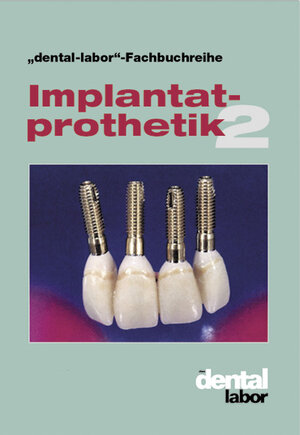 Buchcover Implantatprothetik 2  | EAN 9783929360974 | ISBN 3-929360-97-7 | ISBN 978-3-929360-97-4