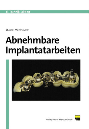 Buchcover Abnehmbare Implantatarbeiten | Axel Mühlhäuser | EAN 9783929360998 | ISBN 3-929360-99-3 | ISBN 978-3-929360-99-8