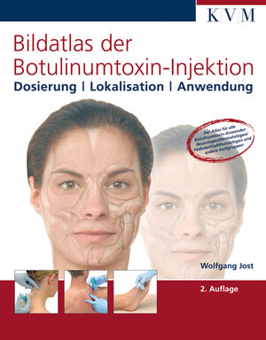Buchcover Bildatlas der Botulinumtoxin-Injektion | Wolfgang Jost | EAN 9783932119415 | ISBN 3-932119-41-X | ISBN 978-3-932119-41-5