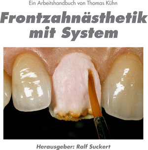 Buchcover Frontzahnästhetik mit System | Thomas Kühn | EAN 9783932599149 | ISBN 3-932599-14-4 | ISBN 978-3-932599-14-9